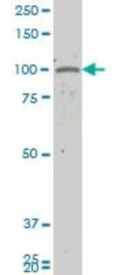 Western Blot: GUCY2C Antibody (2G7) [H00002984-M09]