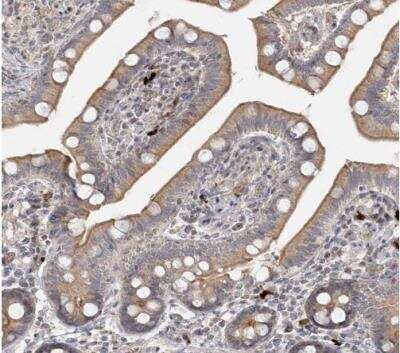 Immunohistochemistry-Paraffin: GUCY2C Antibody [NBP1-81788]