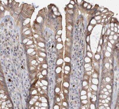 Immunohistochemistry-Paraffin: GUCY2C Antibody [NBP1-81788]