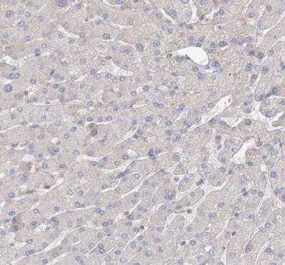 Immunohistochemistry-Paraffin: GUCY2C Antibody [NBP1-81788]