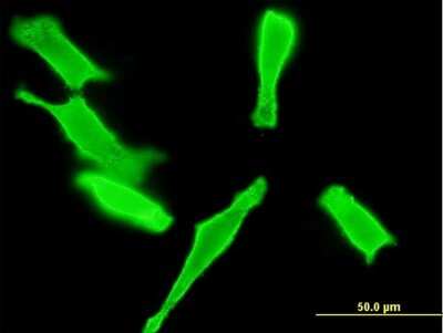 Immunocytochemistry/ Immunofluorescence: GUCY2D Antibody (1E6) [H00003000-M06]