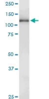 Western Blot: GUCY2D Antibody (4E12) [H00003000-M01]