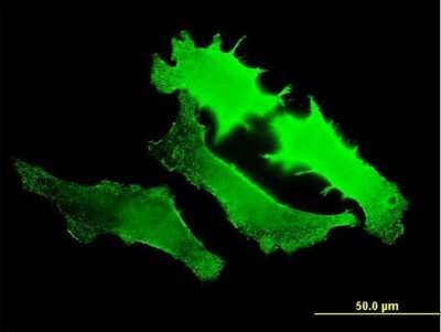 Immunocytochemistry/ Immunofluorescence: GUCY2D Antibody (7E5) [H00003000-M07]