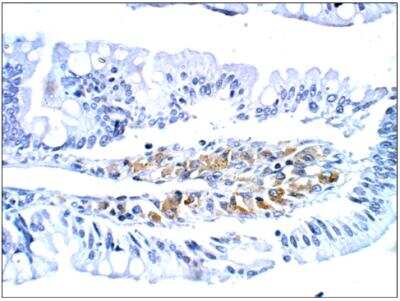 Immunohistochemistry-Paraffin: GUCY2D Antibody [NBP3-12211]
