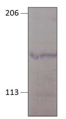 Western Blot: GUCY2D Antibody [NBP3-12211]