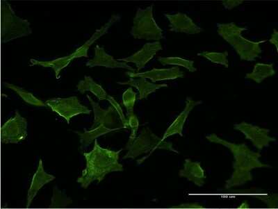 Immunocytochemistry/ Immunofluorescence: GUCY2D Antibody (X1) [H00003000-M09]