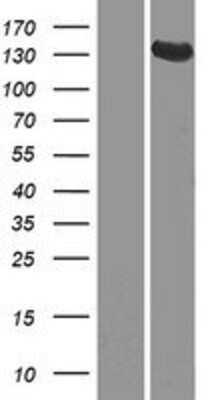 Western Blot: GUCY2D Overexpression Lysate [NBP2-09048]