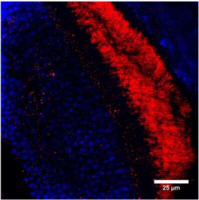 Immunohistochemistry-Paraffin: GUCY2F Antibody [NBP3-12219]