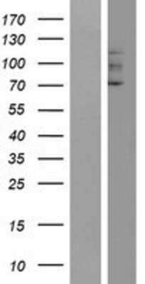 Western Blot: GUCY2F Overexpression Lysate [NBP2-08197]