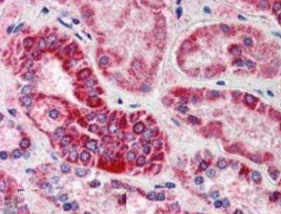 Immunohistochemistry-Paraffin: GULP1/CED-6 Antibody [NB100-1042]