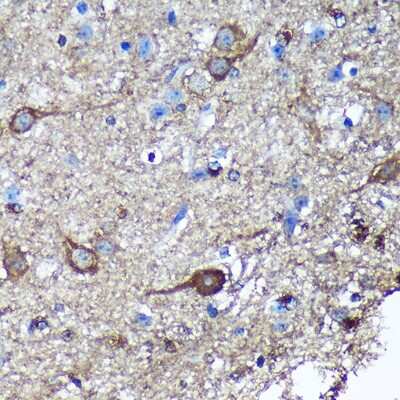 Immunohistochemistry-Paraffin: GULP1/CED-6 Antibody - Azide and BSA Free [NBP3-03258]