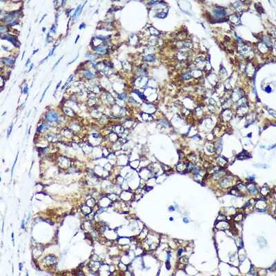 Immunohistochemistry-Paraffin: GULP1/CED-6 Antibody - Azide and BSA Free [NBP3-03258]