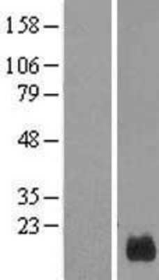 Western Blot: GUSBP5 Overexpression Lysate [NBL1-12608]