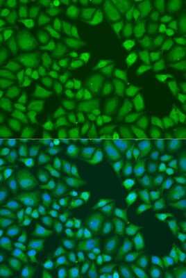 Immunocytochemistry/ Immunofluorescence: GW182 Antibody - BSA Free [NBP3-03014]