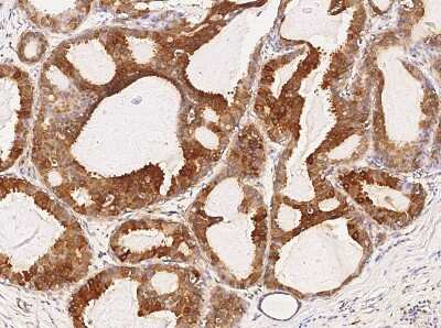 Immunohistochemistry: GW182 Antibody [NBP3-06657]