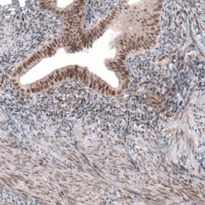 Immunohistochemistry-Paraffin: GW182 Antibody [NBP1-88231]