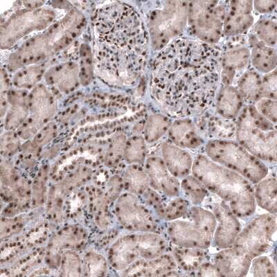 Immunohistochemistry-Paraffin: GW182 Antibody [NBP1-88231]