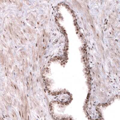 Immunohistochemistry-Paraffin: GW182 Antibody [NBP1-88231]