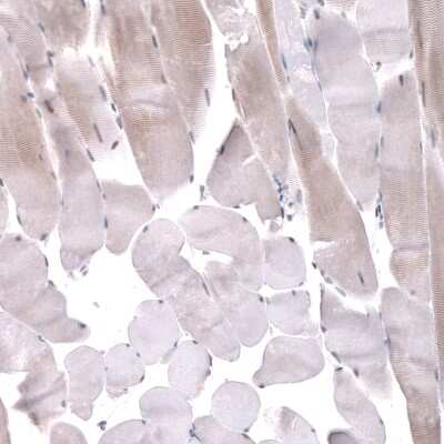 Immunohistochemistry-Paraffin: GW182 Antibody [NBP1-88231]