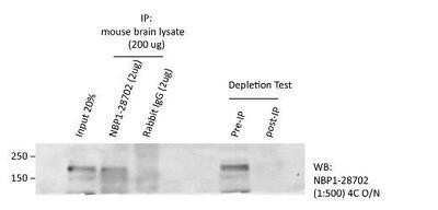 Immunoprecipitation: GW182 Antibody [NBP1-28702]