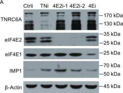 Western Blot: GW182 Antibody [NBP1-28751]