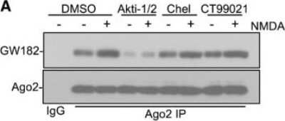 Western Blot: GW182 Antibody [NBP1-57134]