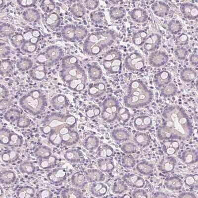 Immunohistochemistry-Paraffin: GYG2 Antibody [NBP2-39032]