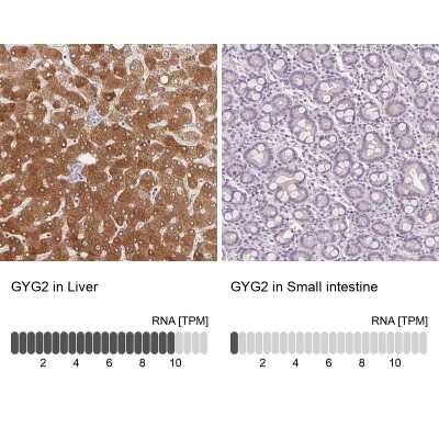 Immunohistochemistry-Paraffin: GYG2 Antibody [NBP2-39032]