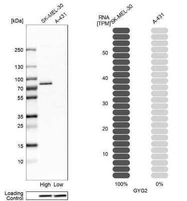 Western Blot: GYG2 Antibody [NBP2-39032]