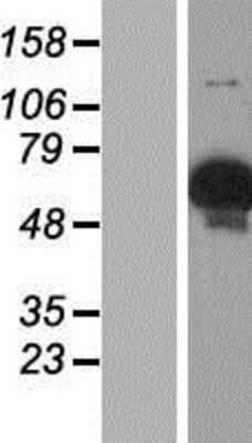 Western Blot: GYG2 Overexpression Lysate [NBP2-08478]