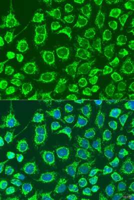 Immunocytochemistry/ Immunofluorescence: GYPB Antibody - BSA Free [NBP3-04815]