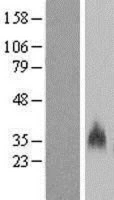 Western Blot: GYPB Overexpression Lysate [NBP2-08148]