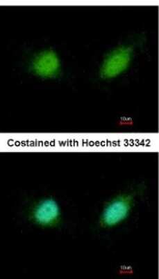 Immunocytochemistry/ Immunofluorescence: Gabpb2 Antibody [NBP2-16572]