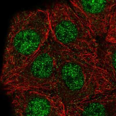 Immunocytochemistry/ Immunofluorescence: Gabpb2 Antibody [NBP2-56677]