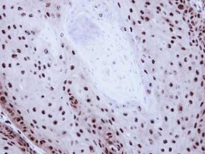 Immunohistochemistry-Paraffin: Gabpb2 Antibody [NBP1-33690]