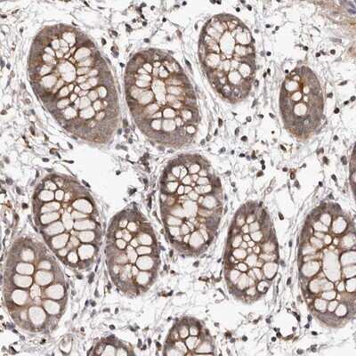 Immunohistochemistry-Paraffin: Gabpb2 Antibody [NBP1-81132]