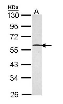 Western Blot: Gabpb2 Antibody [NBP1-33690]