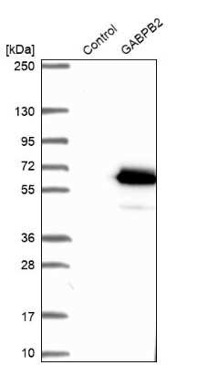 Western Blot: Gabpb2 Antibody [NBP1-81132]