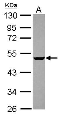 Western Blot: Gabpb2 Antibody [NBP2-16571]