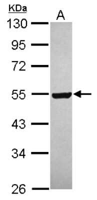 Western Blot: Gabpb2 Antibody [NBP2-16572]