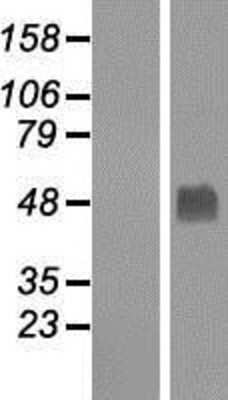 Western Blot: Gabpb2 Overexpression Lysate [NBP2-05555]