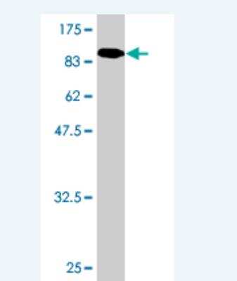 Western Blot: Galactosylceramidase/GALC Antibody (2D1) [H00002581-M01]