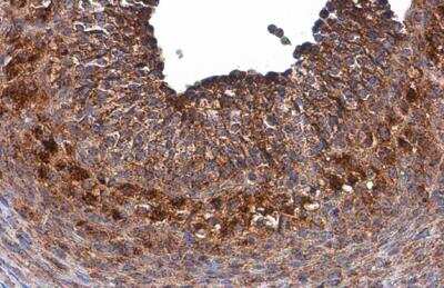 Immunohistochemistry-Paraffin: Galactosylceramidase/GALC Antibody [NBP2-16578]