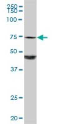 Western Blot: Galactosylceramidase/GALC Antibody [H00002581-D01P]