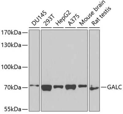 Western Blot: Galactosylceramidase/GALC AntibodyBSA Free [NBP3-03718]