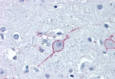 Immunohistochemistry-Paraffin: Galanin R3/GALR3 Antibody [NBP3-14330]