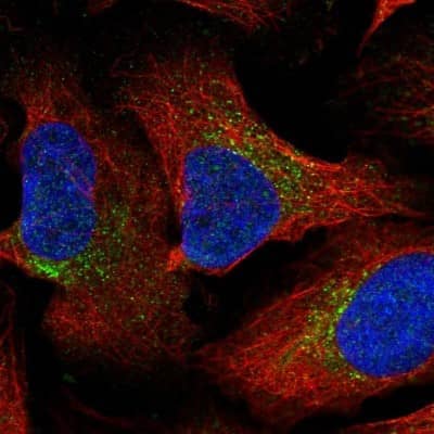 Immunocytochemistry/ Immunofluorescence: Galanin Antibody [NBP2-33582]