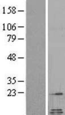 Western Blot: Galanin Overexpression Lysate [NBL1-10942]