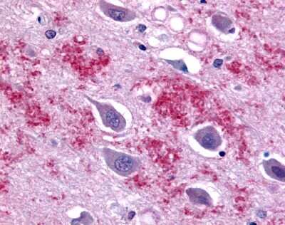 Immunohistochemistry-Paraffin: Galanin R1/GALR1 Antibody - BSA Free [NLS4013]