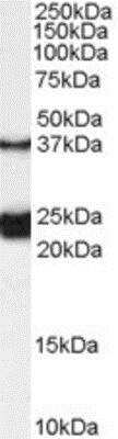 Western Blot: Galanin R1/GALR1 Antibody [NB100-57080]